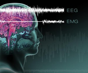 EEG/EMG lines show progression from wakefulness into cataplexy-when muscle tone suddenly disappears. (PRNewsFoto/SRI International)